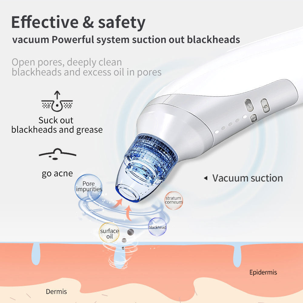 Novaskin™️ Pro Pore Vacuum – Blackhead Removal & Deep Cleaning Device