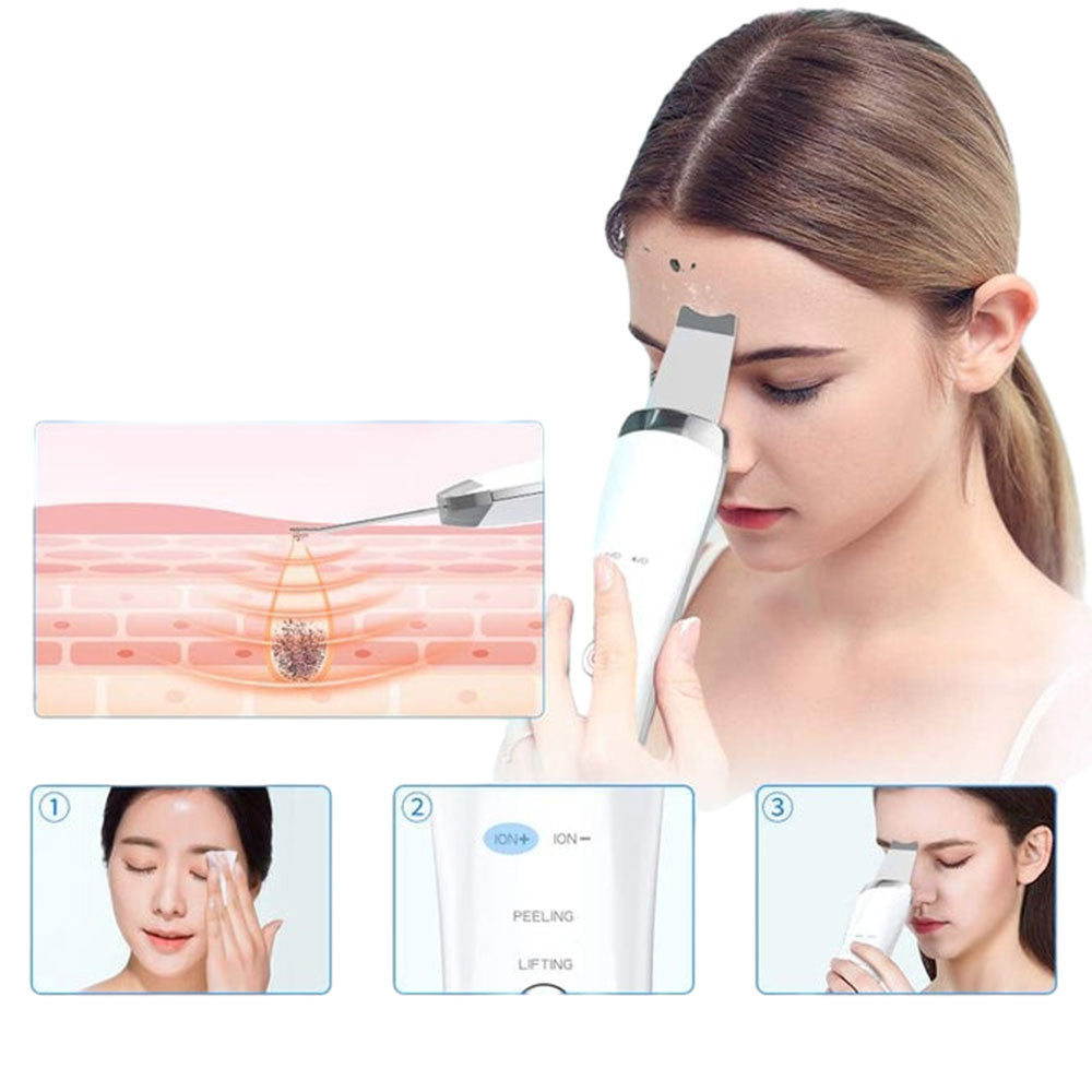 Novaskin™️ Ultrasonic Skin Scrubber – Deep Pore Cleanser & Skin Tightening Spatula